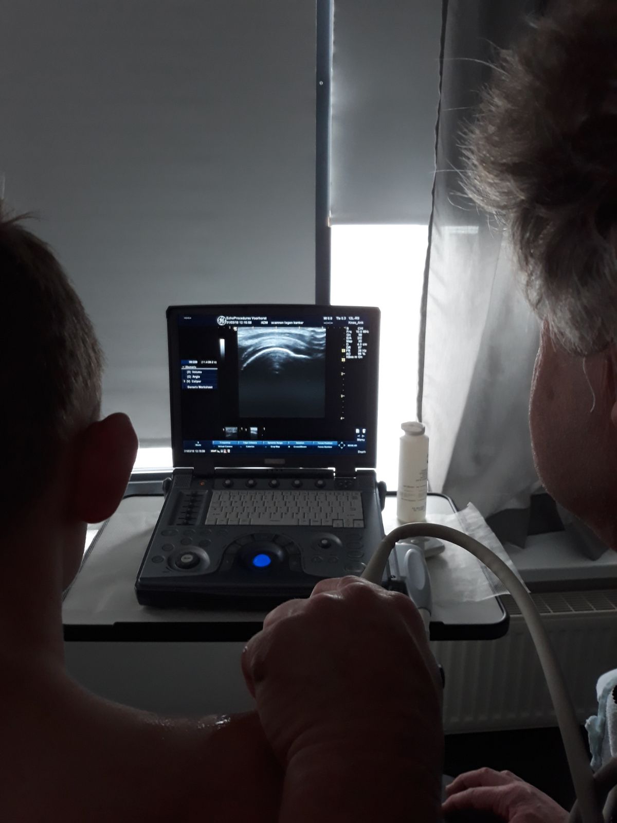 Een echoscan bij schouderklachten! Echoprocedures